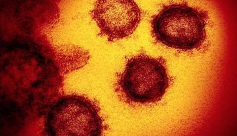 Brasileiro com coronavírus se reuniu com 30 familiares; média de infecção é de mais três pessoas