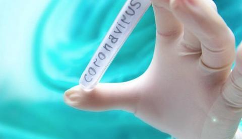 Sobe para 182 o número de casos suspeitos de coronavírus no Brasil