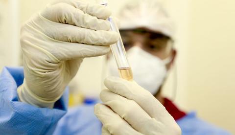 Genoma do vírus que infectou brasileiro é sequenciado em SP