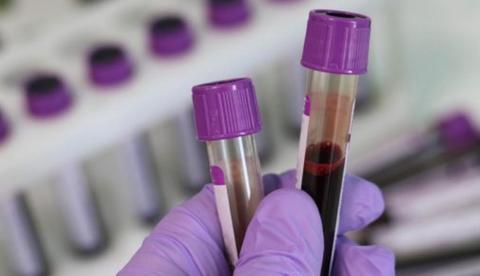 Brasil tem 13 casos confirmados de coronavírus 