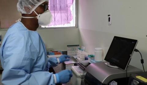 Laboratório no Amazonas começa a realizar testes para diagnóstico do novo coronavírus 