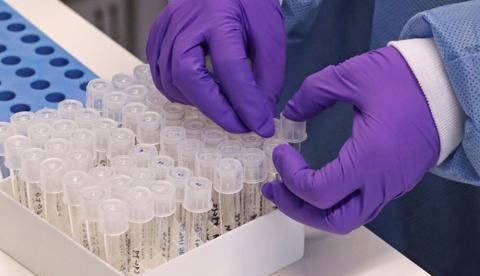 Guiana registra primeira morte por coronavírus