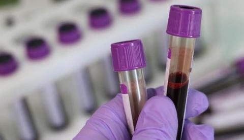 Mais de 2 mil médicos e enfermeiras pegaram vírus na Itália