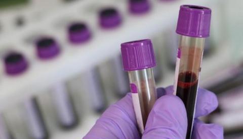 Amazonas deve receber mais de 200 kits para testes do novo coronavírus 