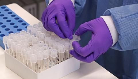 Sobe para 13 o número de mortes por coronavírus no estado do Rio