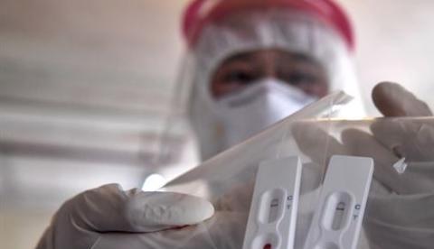 Brasil fará teste em massa neste mês para saber número de infectados por coronavírus