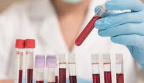 Familiares de índia infectada fazem exames para coronavírus no Amazonas