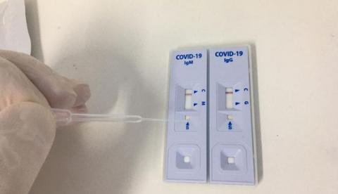 Ufam realiza testes rápidos para controle da Covid-19 em profissionais da saúde 