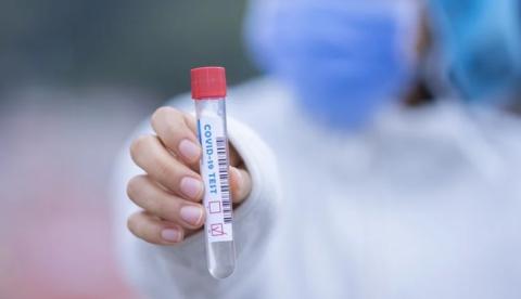 Amazonas atinge 10 mil infectados pelo novo coronavírus 