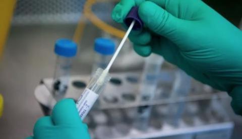 Diagnósticos confirmam aumento dos casos de covid-19 em municípios do Amazonas