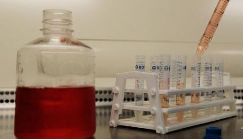 Falha leva EUA a suspender teste com vacina experimental da Aids