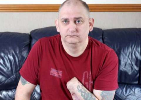 Homem corta a própria mão com guilhotina caseira por não conseguir atendimento médico