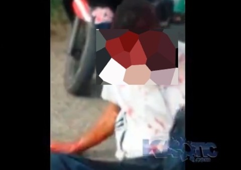Rosto de homem é arrancado em acidente de moto sem capacete