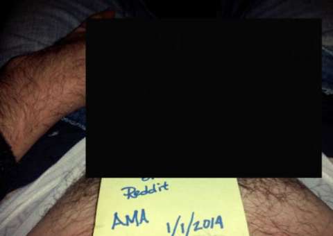 Homem fica famoso na web por nascer com duas genitálias