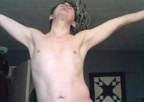 Agenesia Gonadal: homem nasce sem pênis e sem testículos 