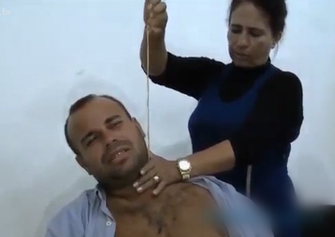 MILAGRE: Em cura espiritual homem tem veia aorta retirada