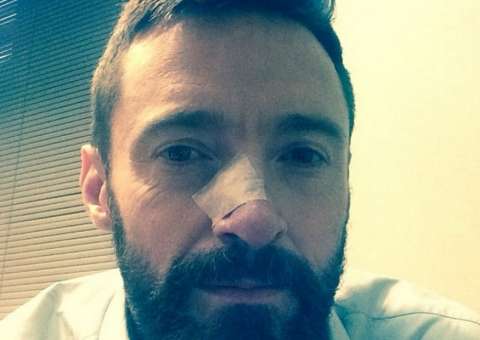 Hugh Jackman  luta contra o câncer de pele novamente