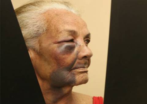 ​Em quatro meses, mais de 600 idosos foram vítimas de violência em Manaus