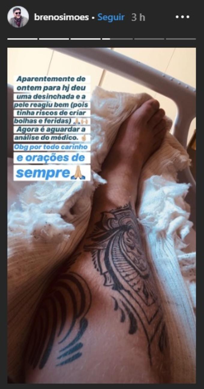 Foto: Reprodução/ Instagram