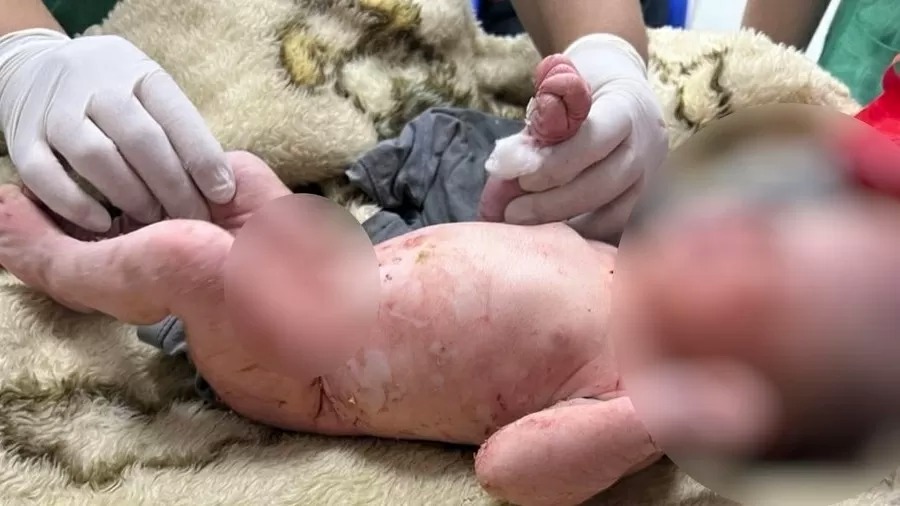 Foto: Divulga&ccedil;&atilde;o Pol&iacute;cia Militar Goi&aacute;s