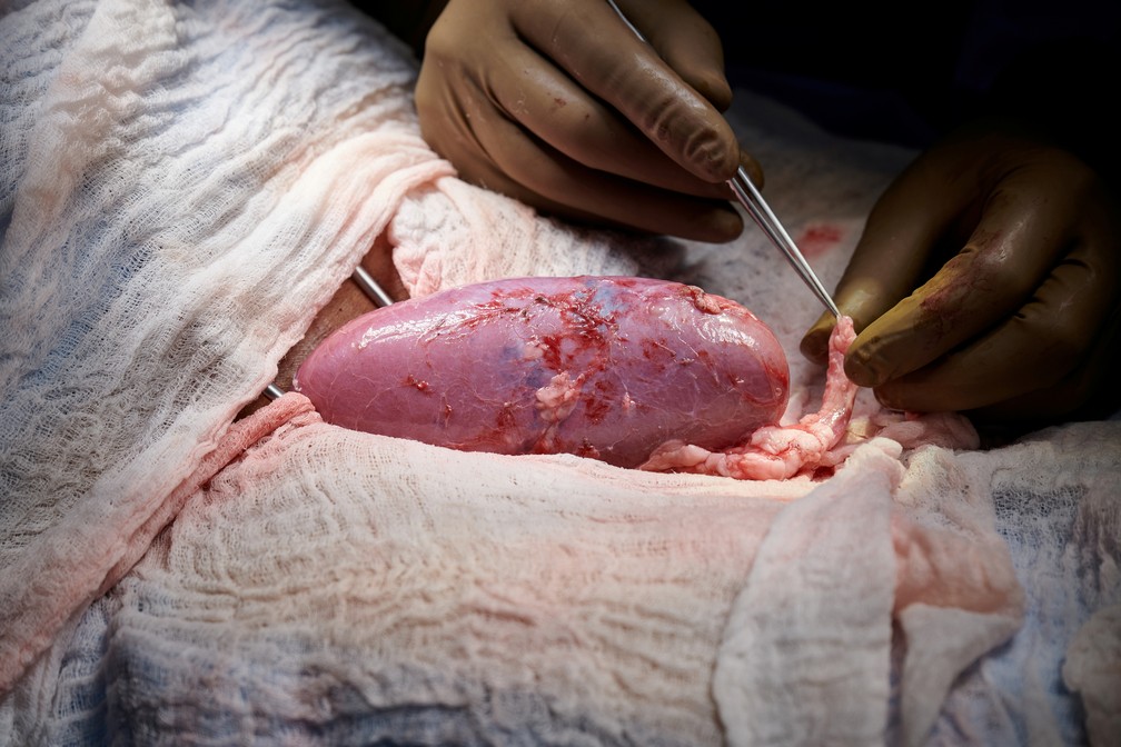 Foto: Joe Carrotta para NYU Langone Health/via Reuters