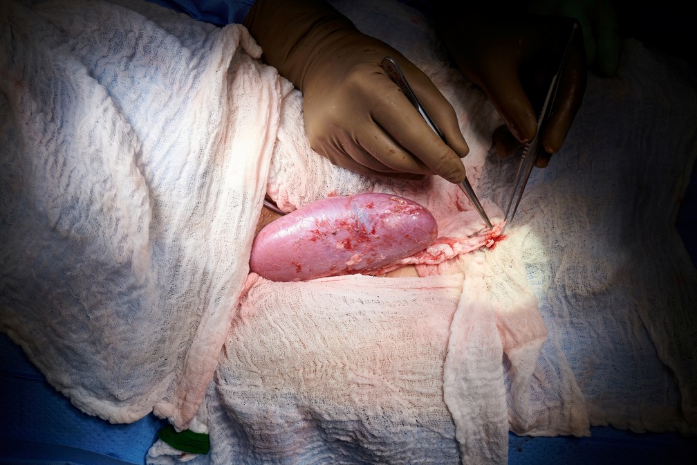 Foto: Joe Carrotta para NYU Langone Health/via Reuters