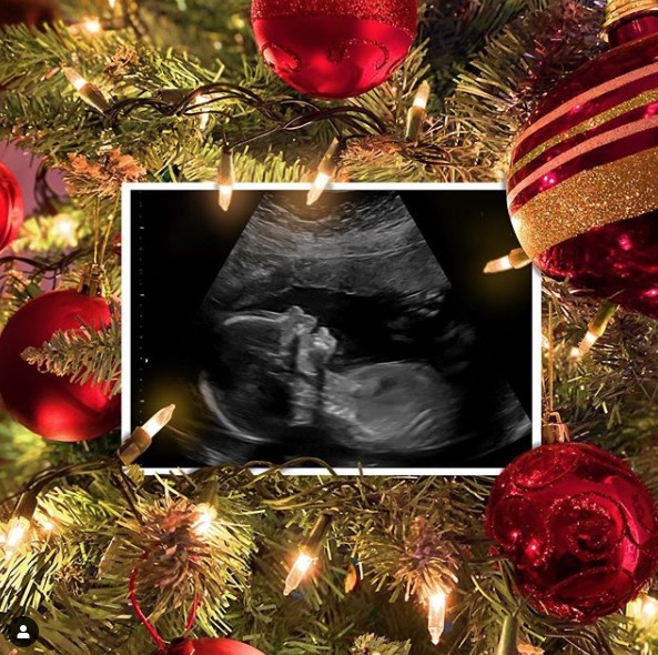 Meghan compartilhou com os seguidores a foto da ultrassom - Foto: Reprodu&ccedil;&atilde;o/ Instagram 