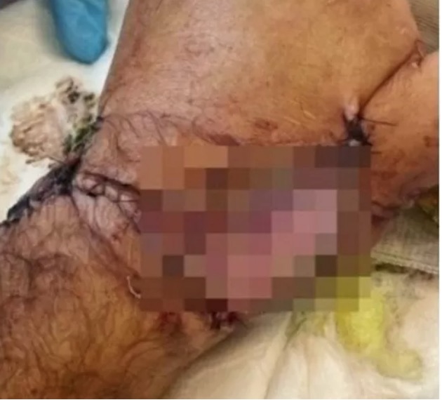 Foto: Reprodu&ccedil;&atilde;o Instagram