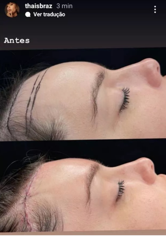 Foto: Reprodu&ccedil;&atilde;o Instagram