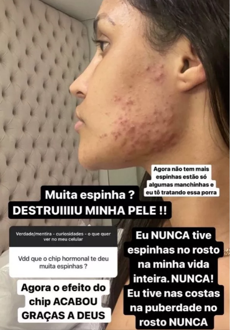 Foto: Reprodu&ccedil;&atilde;o Instagram