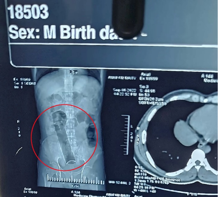 Foto: Divulga&ccedil;&atilde;o