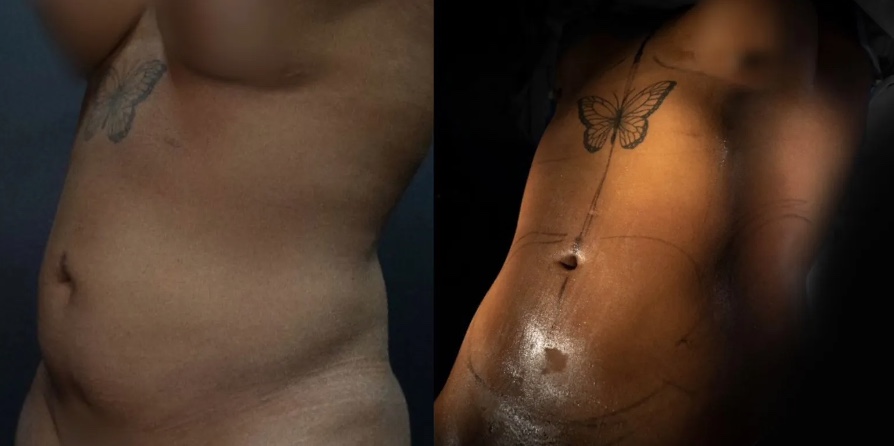 Foto: Divulga&ccedil;&atilde;o