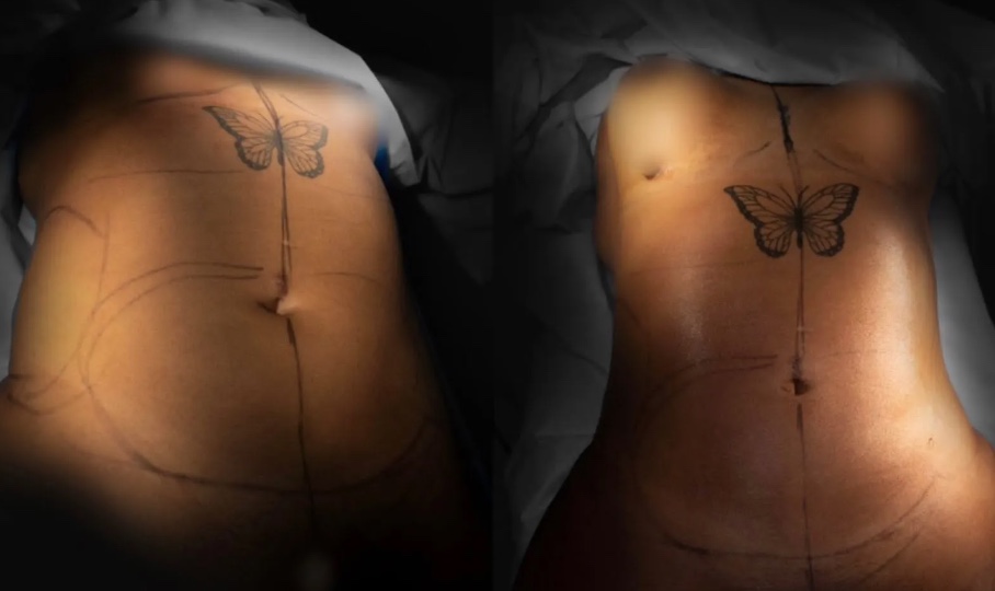 Foto: Divulga&ccedil;&atilde;o