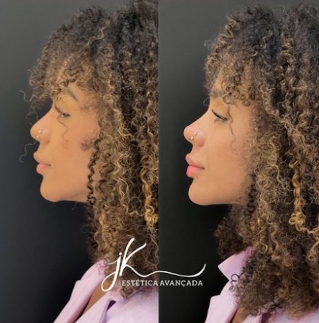 Foto: JK est&eacute;tica avan&ccedil;ada 