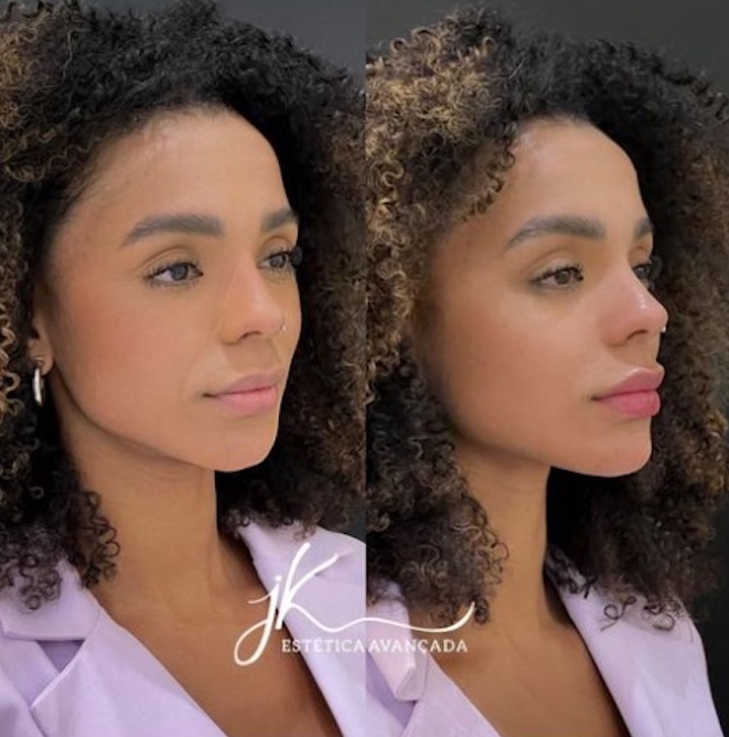 Foto: JK est&eacute;tica avan&ccedil;ada 