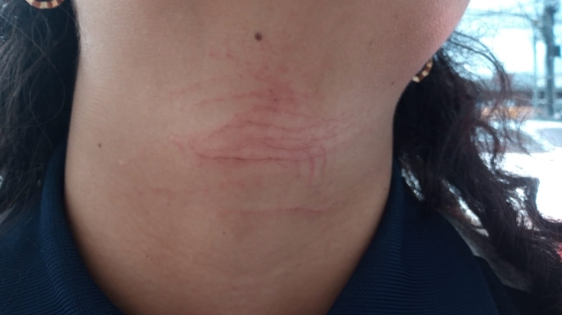 Pesco&ccedil;o da v&iacute;tima - Foto: Reprodu&ccedil;&atilde;o