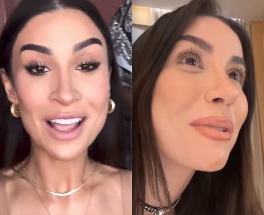 Fotos com poucos meses de diferen&ccedil;a mostram o resultado da pl&aacute;stica. 