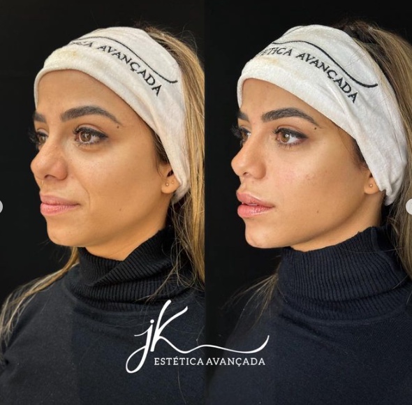 Antes e depois de Key Alves - Foto: Reprodu&ccedil;&atilde;o/Instagram