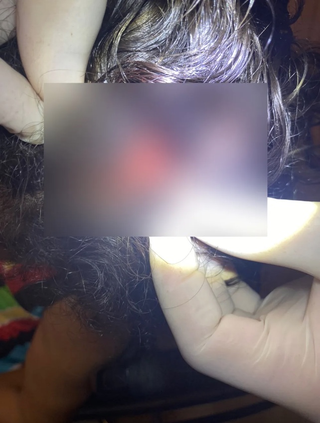 Mulher foi resgatada com cortes na cabe&ccedil;a. &mdash; Foto: Divulga&ccedil;&atilde;o / Pol&iacute;cia Civil do Maranh&atilde;o