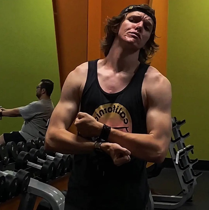 Johnathon mostra costas com quadro grave de acne ap&oacute;s usar anabolizante. - Foto:&nbsp;Reprodu&ccedil;&atilde;o Instagram @john_joshua_james