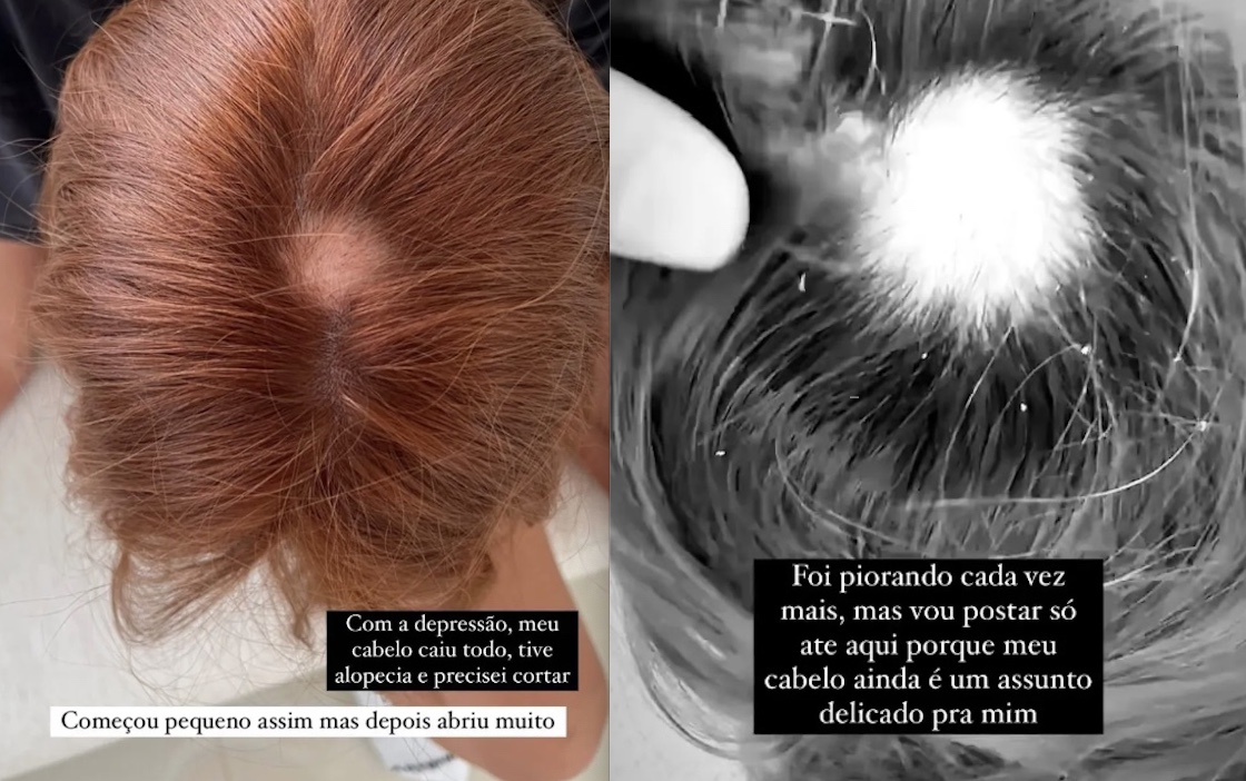 Imagens: Reprodu&ccedil;&atilde;o/Instagram