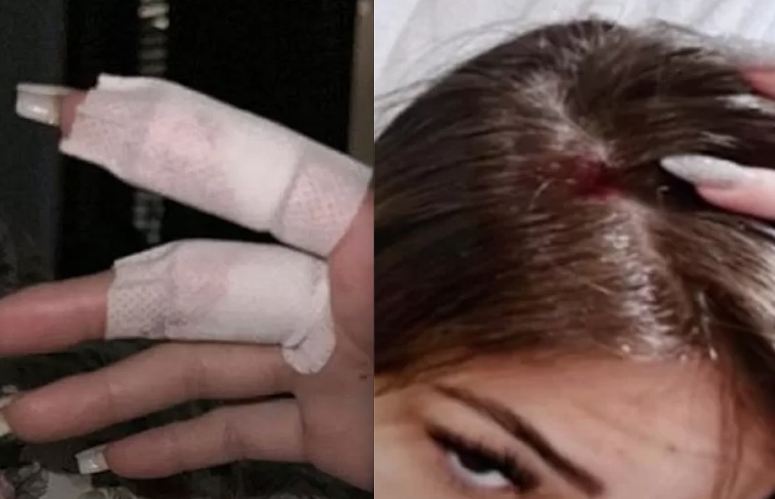 Imagens: Reprodu&ccedil;&atilde;o