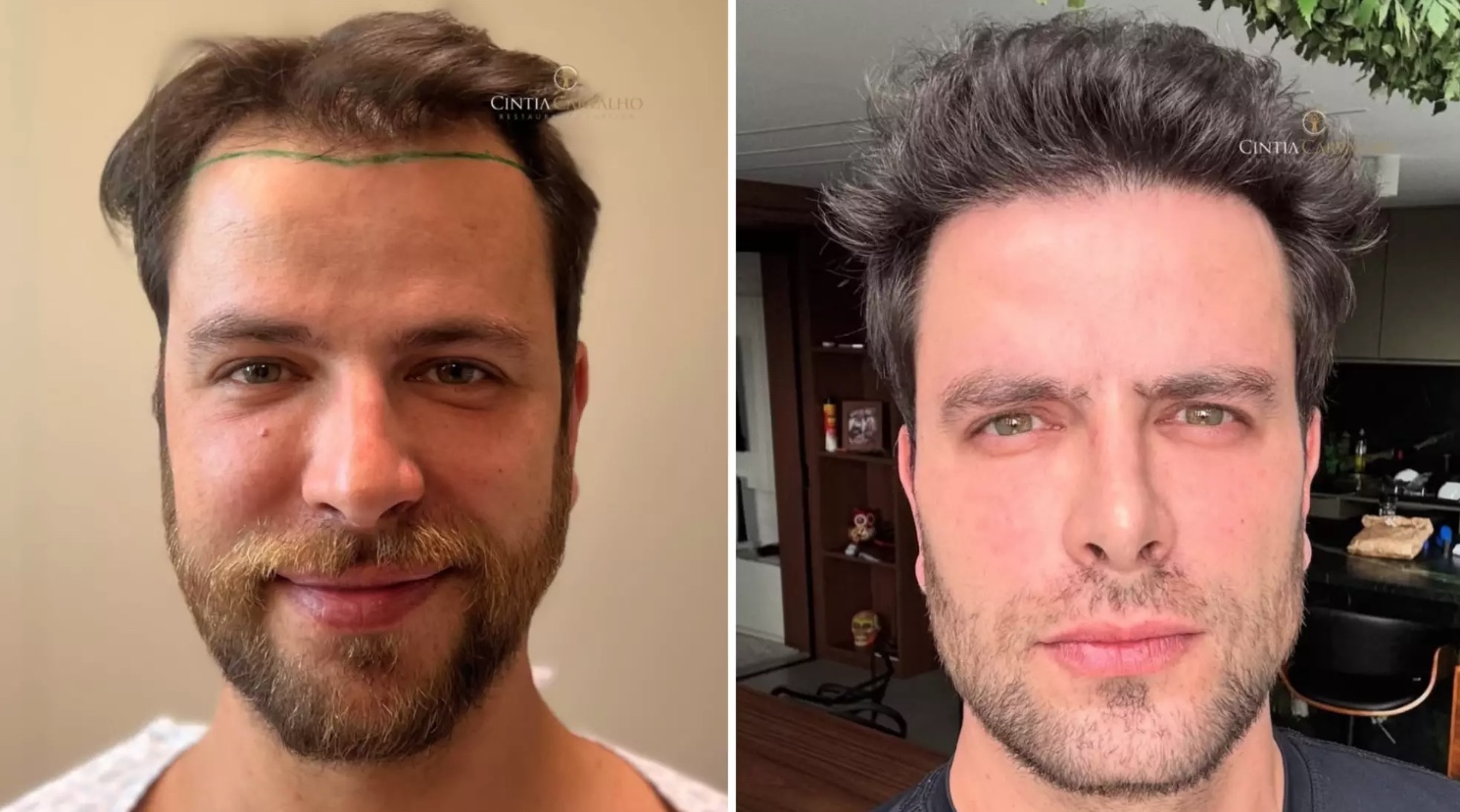 Foto: Reprodu&ccedil;&atilde;o/Instagram