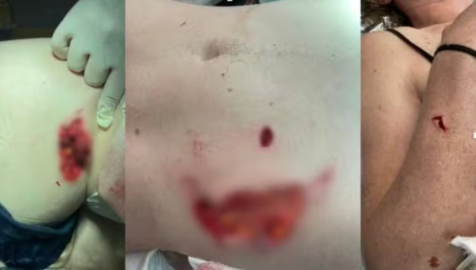  Foto: Reprodu&ccedil;&atilde;o