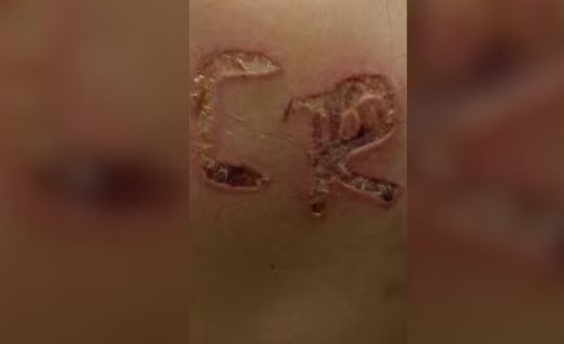 Foto: Reprodu&ccedil;&atilde;o