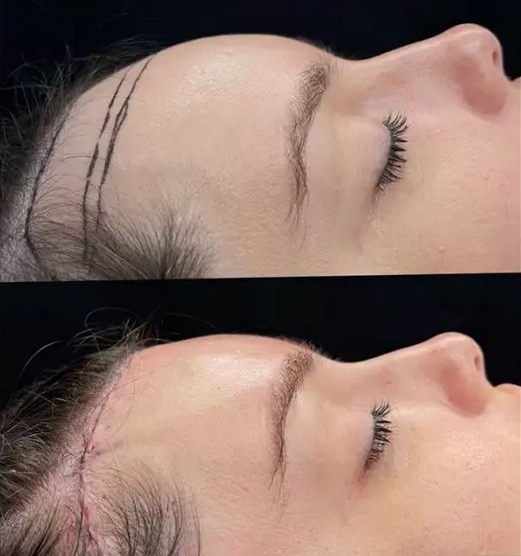 Foto: Reprodu&ccedil;&atilde;o Instagram @thaisbraz