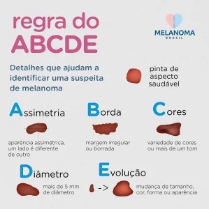 Imagem: Reprodu&ccedil;&atilde;o / Melanoma Brasil