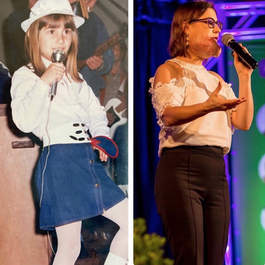 Lu Dorini na inf&acirc;ncia j&aacute; com a condi&ccedil;&atilde;o, mas sem estar evidente - Foto: Reprodu&ccedil;&atilde;o Instagram