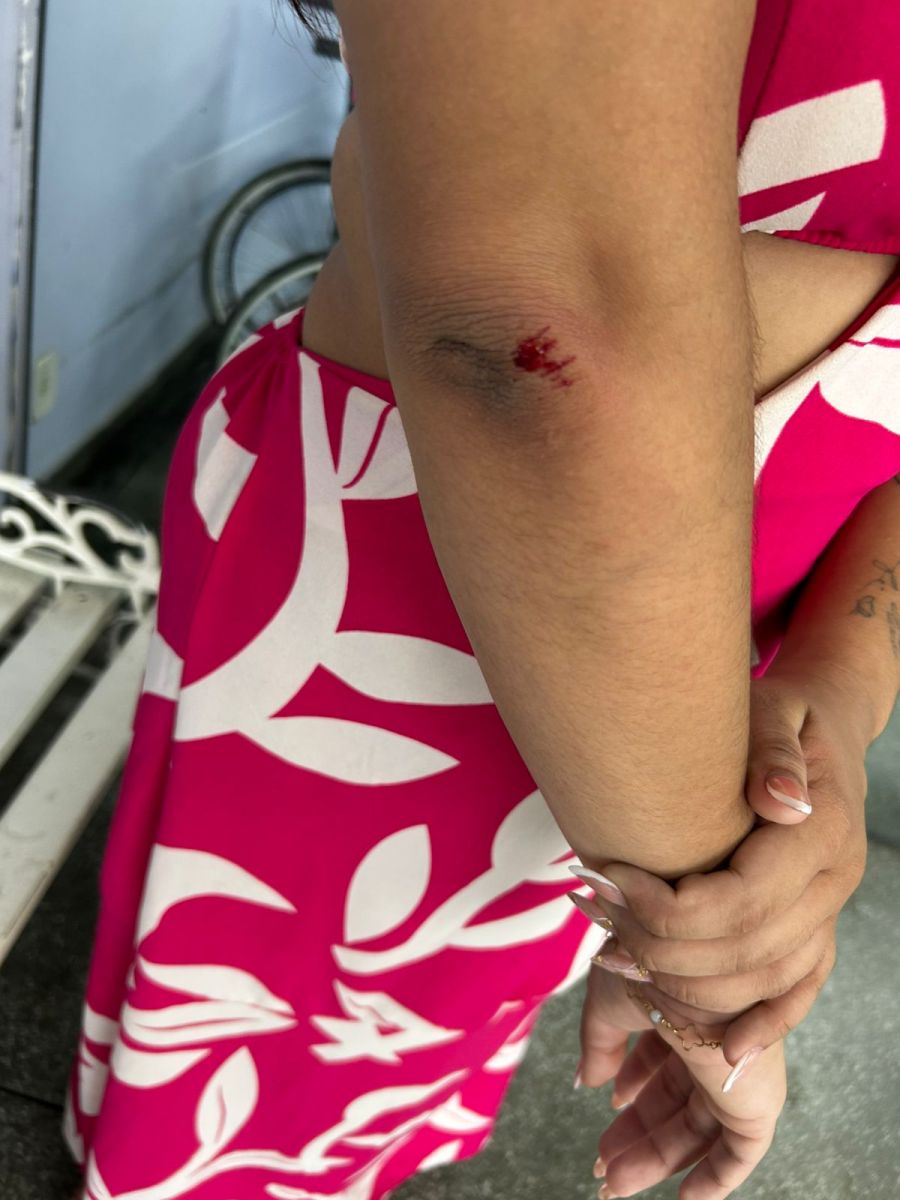 Qu&eacute;ssia ficou ferida no ataque- Foto: Jander Robson/Portal do Holanda