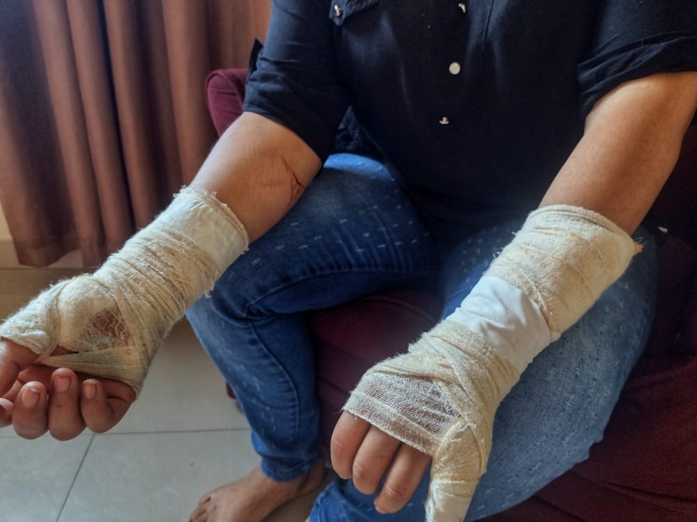 M&atilde;e usou as m&atilde;os para quebrar vidros de porta de hospital p&uacute;blico - Foto: Jander Robson/Portal do Holanda